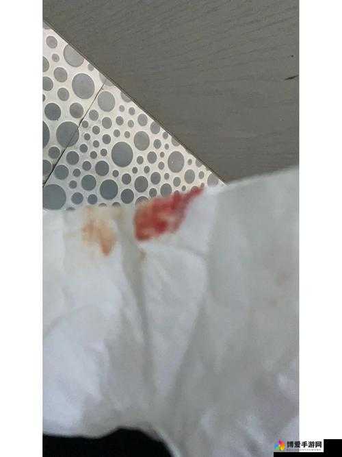 肛门用棉签塞一点点就有血：这究竟是何原因引发的症状
