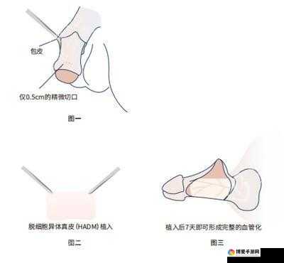 探寻实现变粗最快方法的高效途径与技巧