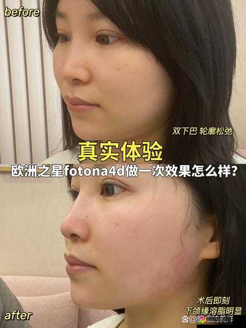 欧洲之星 4D 做一次效果怎么样：全面解析与真实体验分享