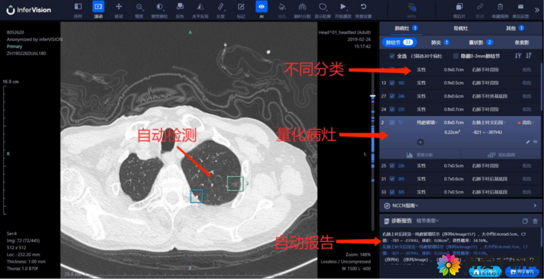 探索胸片曝光率软件的奥秘，提高医疗影像质量