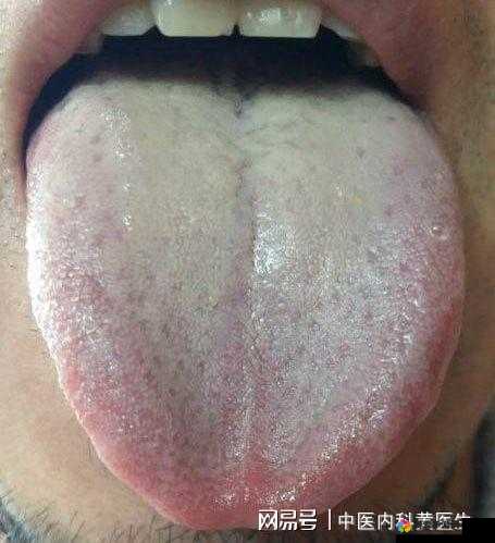 温热的舌头搅拌着疼怎么办到底是怎么回事该如何解决