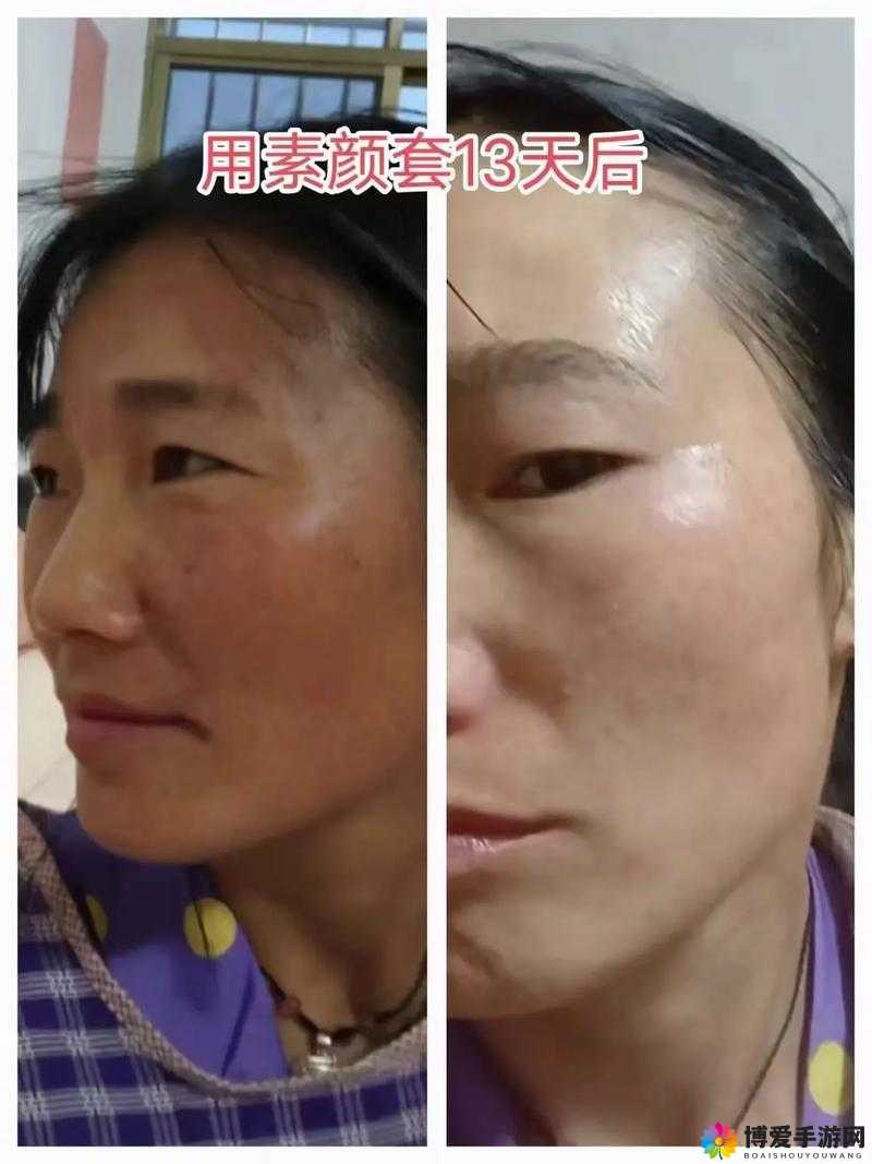 国产 377vc 精华 2 真能祛斑吗：其祛斑效果究竟如何的详细解析