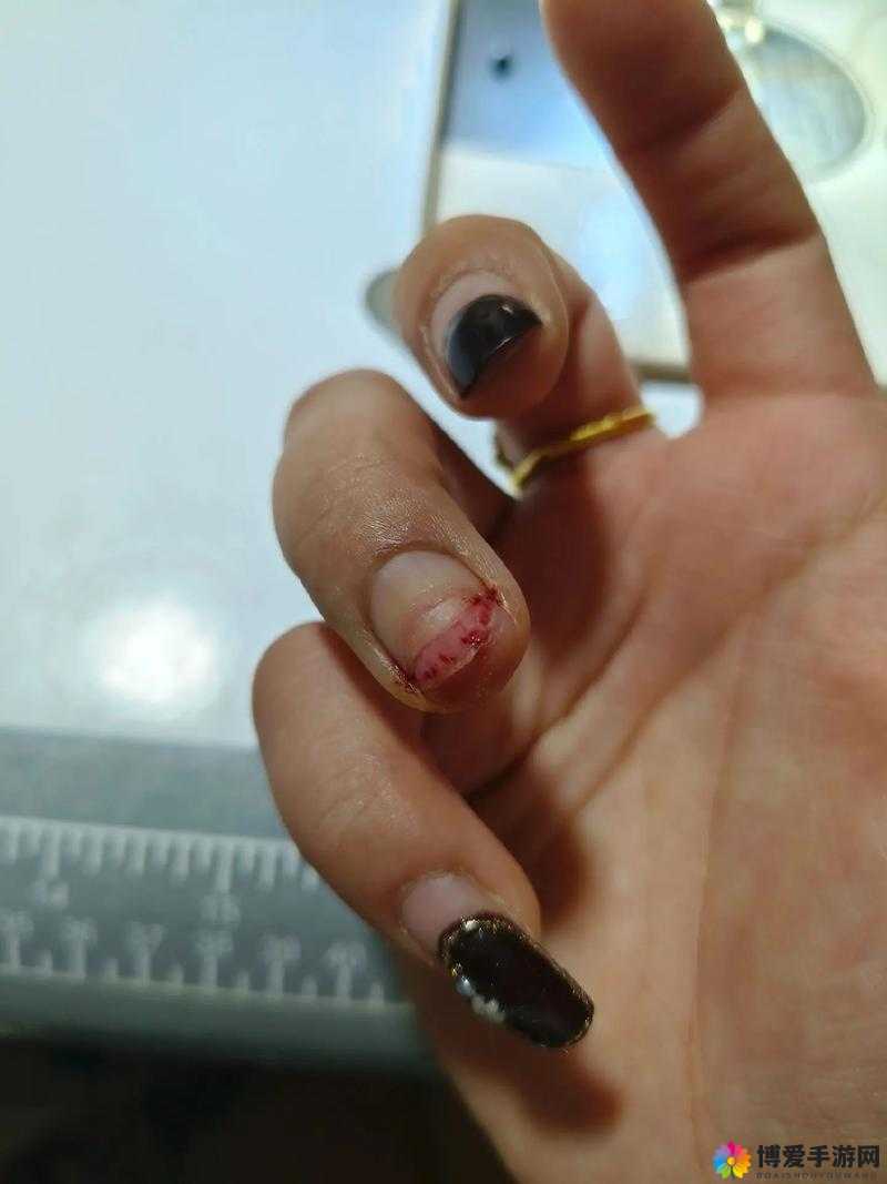 一个手指头就疼成这样视频：探寻疼痛背后的隐情