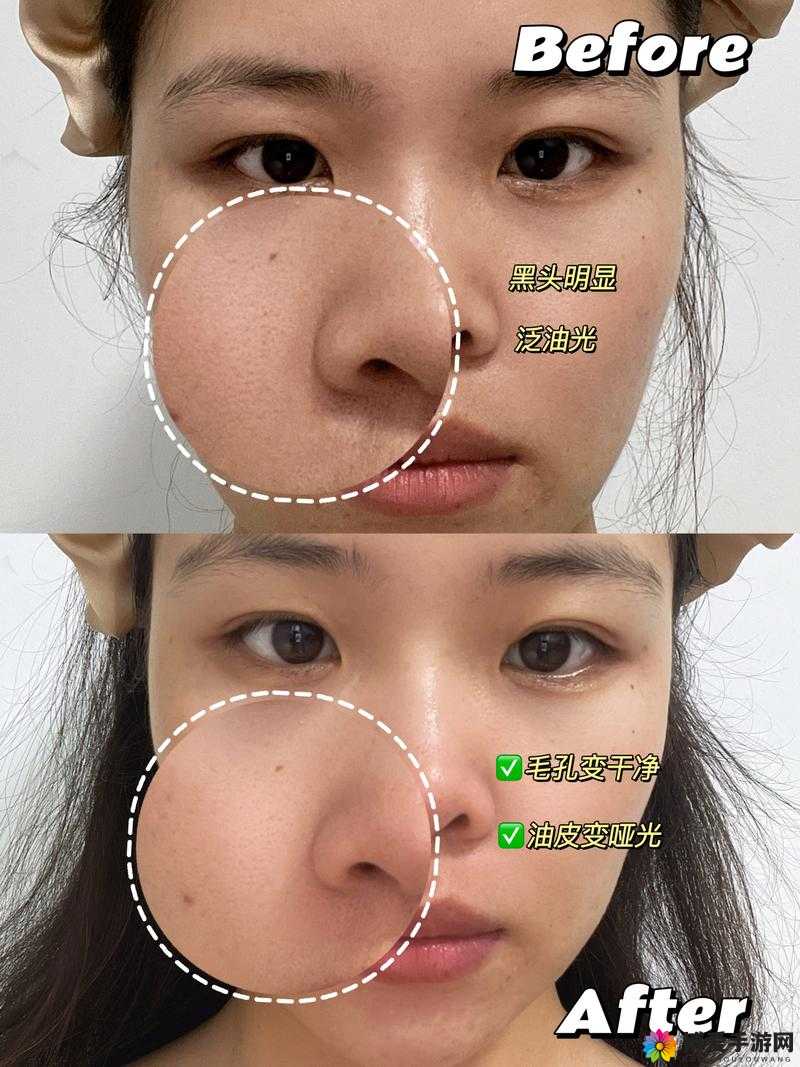 粗大黑头紫大黑头紫挤进:探秘其背后的奥秘