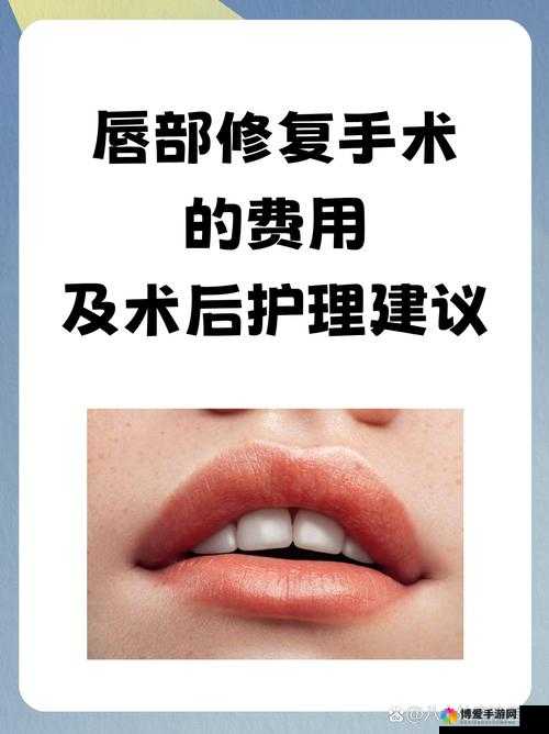 切唇手术一般所需费用大概是多少呢
