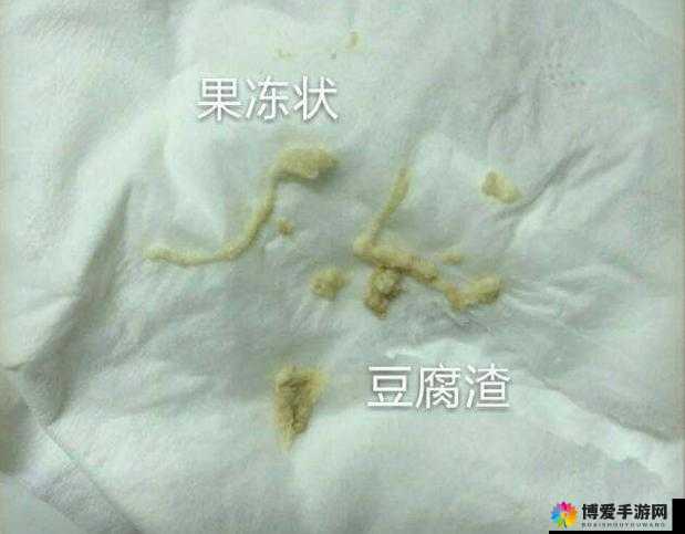 女生次数多了是否会出现豆腐渣分泌物相关探讨
