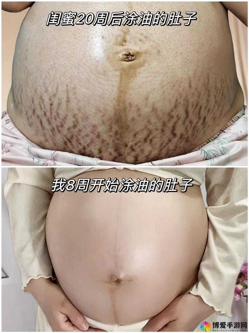 大肚子怀孕无限怀孕生孩子:关于这一奇特现象的深入探讨与分析