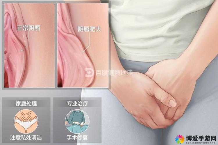 阴脣肥大的图示蝴蝶：独特之美引发的别样思考