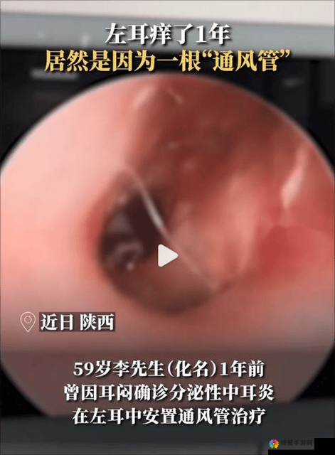 蘑菇视频黑料爆料：震惊众人的背后真相大揭秘
