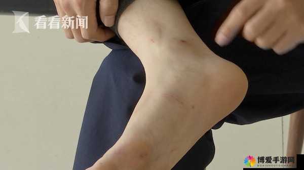 警察脚底心遭刷子恶意刷拭事件引发关注
