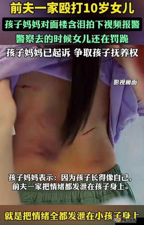 打女孩子:一种不恰当的行为,可能导致严重后果