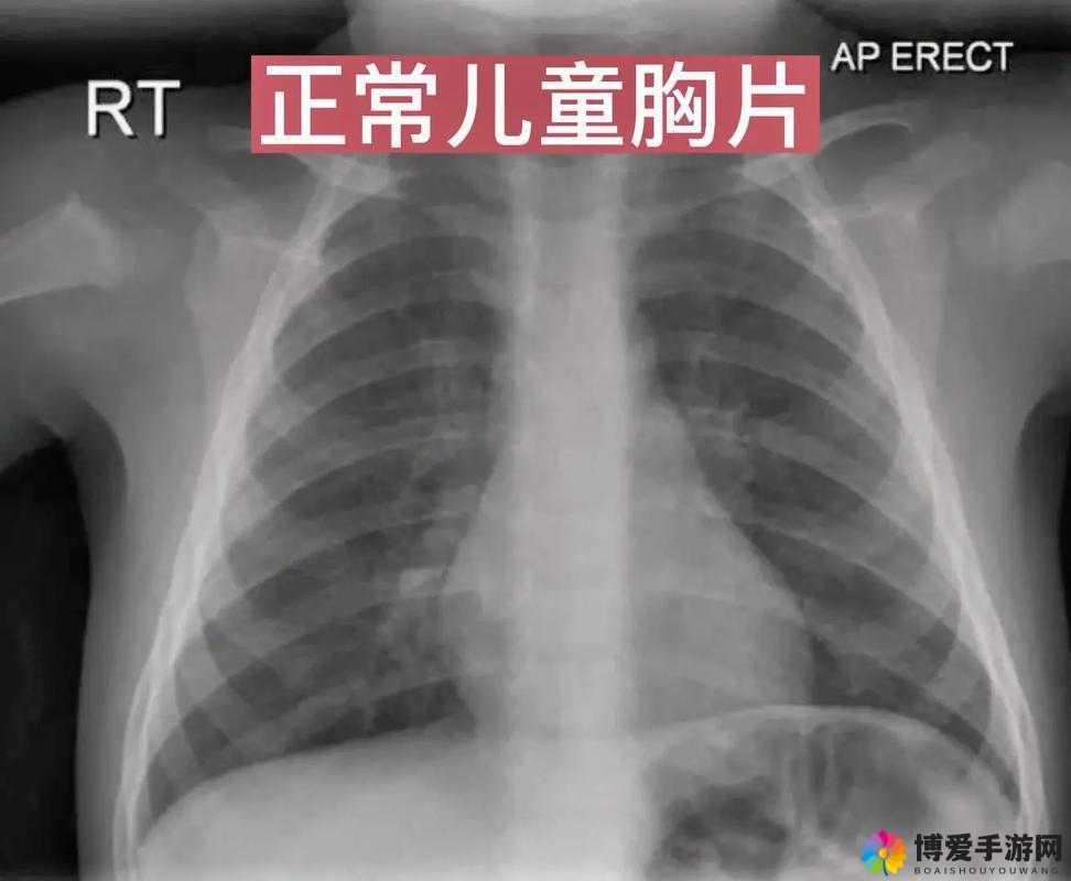 100%胸片曝光率免费：的健康检查全力以赴
