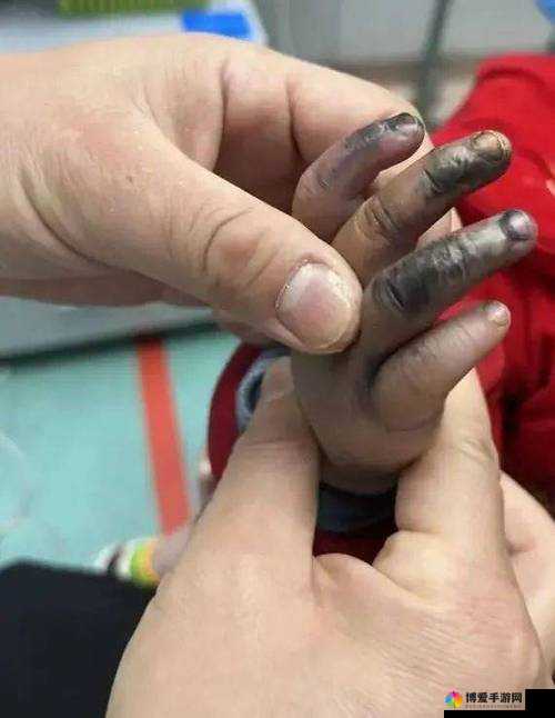 宝宝才两根手指就疼哭了怎么回事：探寻背后的隐情