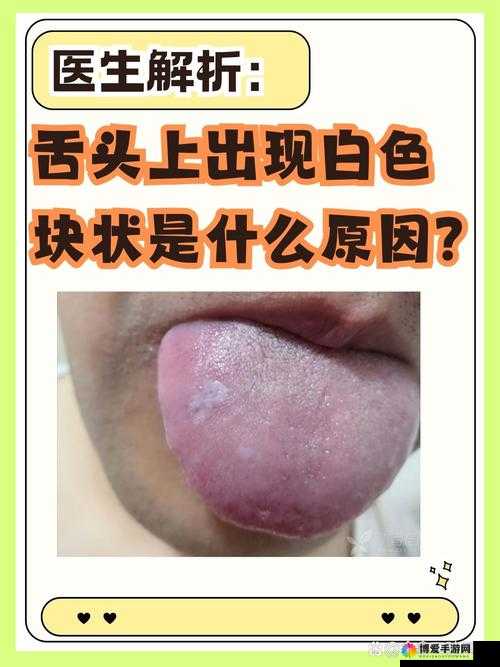 往下面放什么像舌头的东西：探寻其中的神秘与疑惑
