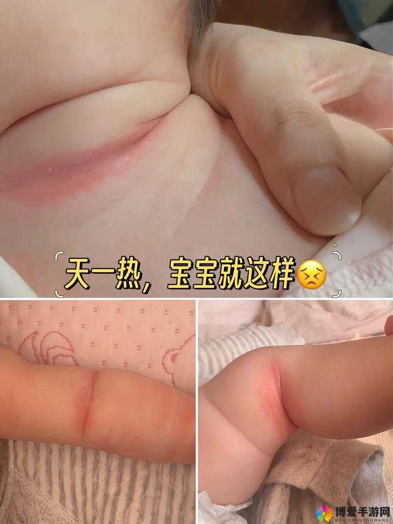 宝宝下面湿透且嘴硬喊疼令人揪心不已