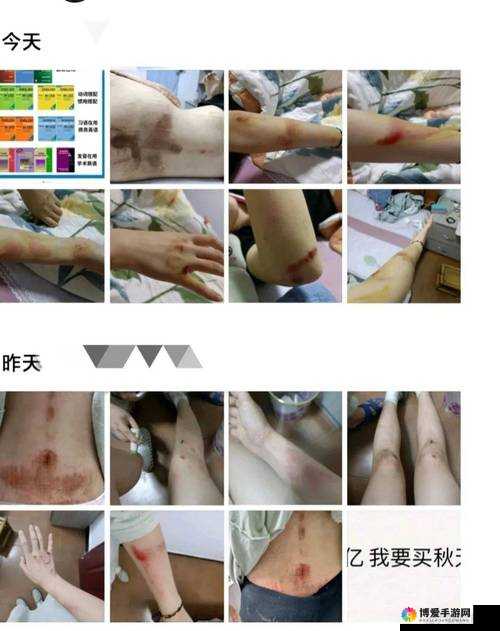12—14 岁幼女裸交：被忽视的儿童性侵害问题