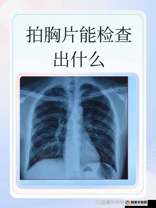 十大曝光胸片平台：揭示真相，守护健康