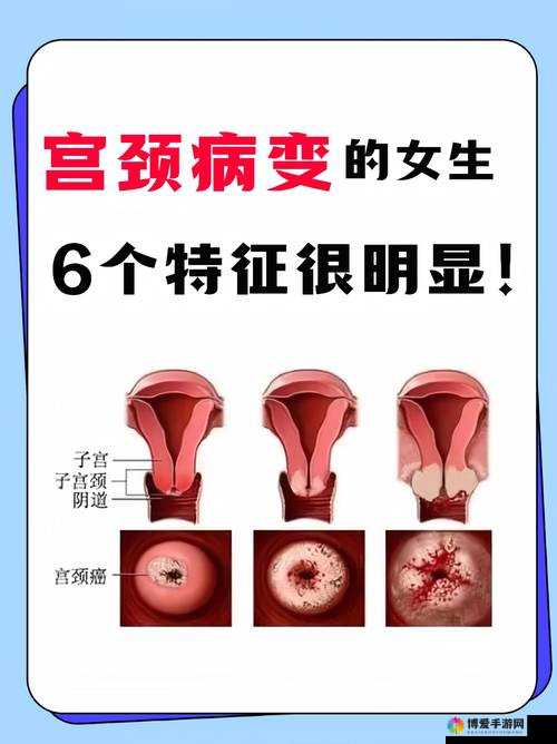 HPV 感染与性接触：你需要知道的一切