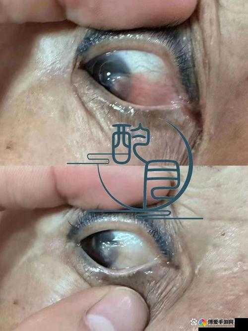 获得超级胬肉系统后,他的生活会发生怎样的变化?