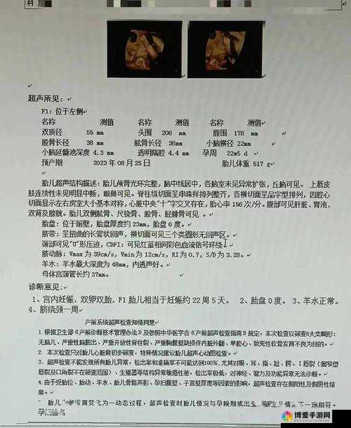 四维哪里做的？B超医生详细解答四维彩超检查地点与注意事项