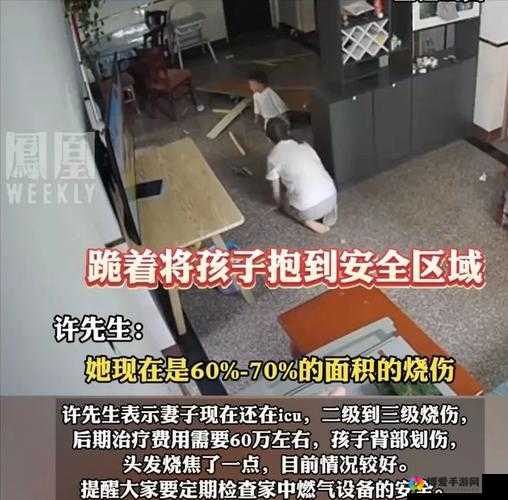 妈妈为毁容儿子生孩子：无私母爱感动万千网友，背后的故事令人泪目