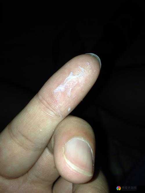 口中黏糊糊的，是怎么回事？专家解读可能的原因